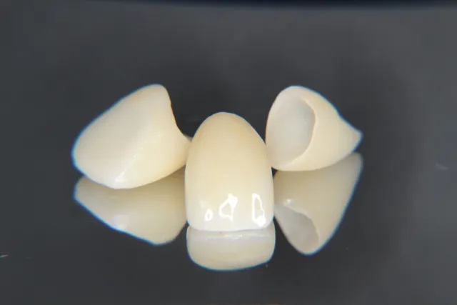 金属アレルギーでお困りの方へ