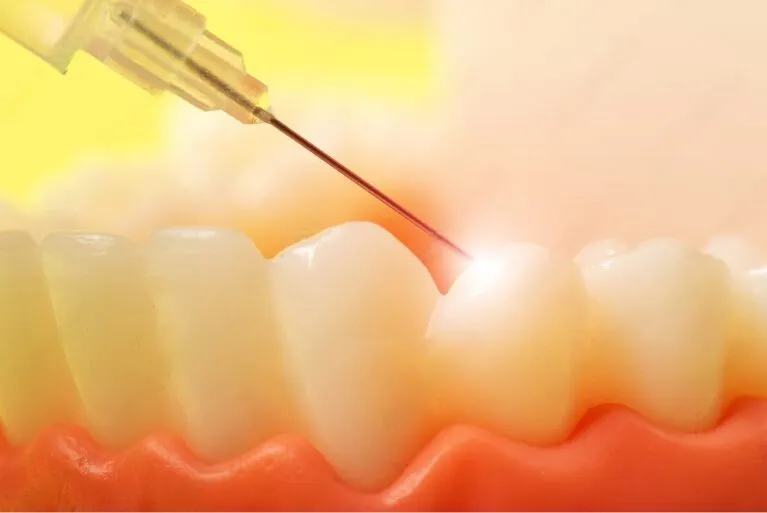 適切な麻酔で痛みを最小限に