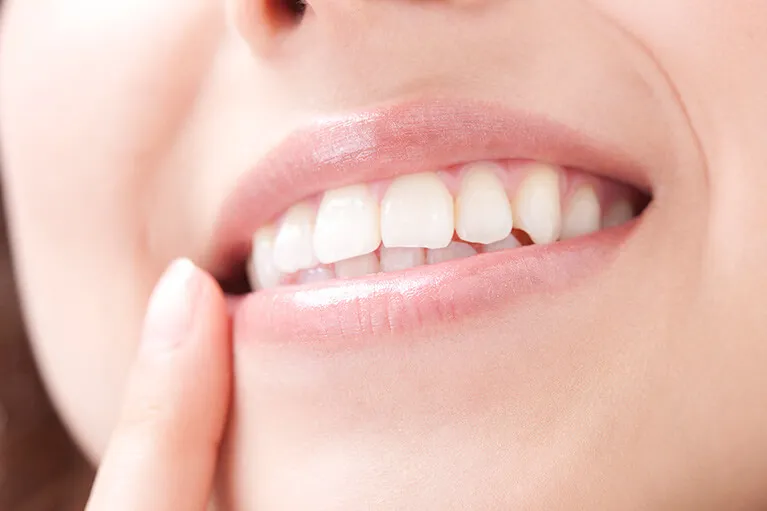 ホワイトニングをお考えの方へ